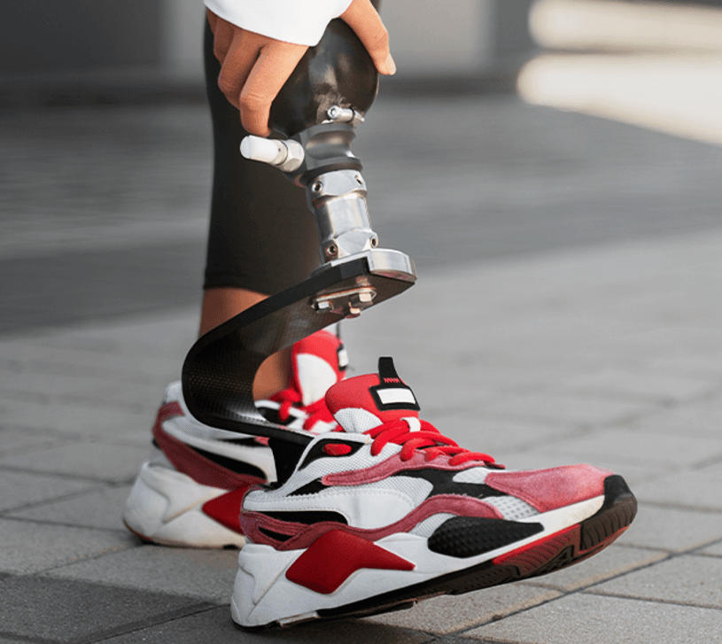 Prosthetic leg with sneaker